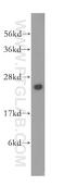 Cytidine/Uridine Monophosphate Kinase 1 antibody, 11360-1-AP, Proteintech Group, Western Blot image 
