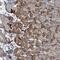 AXL Receptor Tyrosine Kinase antibody, NBP2-38345, Novus Biologicals, Immunohistochemistry paraffin image 
