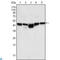 Glycogen Synthase Kinase 3 Beta antibody, LS-C814019, Lifespan Biosciences, Western Blot image 