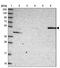 Amylase Alpha 1C (Salivary) antibody, NBP2-46713, Novus Biologicals, Western Blot image 