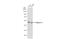 Pygopus Family PHD Finger 2 antibody, GTX119726, GeneTex, Western Blot image 