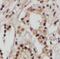 PRKCA-binding protein antibody, FNab06434, FineTest, Immunohistochemistry paraffin image 