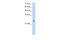 Alcohol Dehydrogenase 6 (Class V) antibody, 29-645, ProSci, Western Blot image 