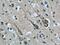 Abl Interactor 2 antibody, 14890-1-AP, Proteintech Group, Immunohistochemistry paraffin image 