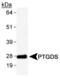 Prostaglandin D2 Synthase antibody, PA1-46022, Invitrogen Antibodies, Western Blot image 