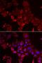 Myotilin antibody, LS-C334718, Lifespan Biosciences, Immunofluorescence image 