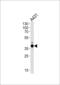Actin Related Protein 2/3 Complex Subunit 1B antibody, MBS9207959, MyBioSource, Western Blot image 
