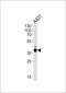 Actin Related Protein 2/3 Complex Subunit 1B antibody, MBS9207959, MyBioSource, Western Blot image 