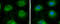 Leucyl-TRNA Synthetase 2, Mitochondrial antibody, GTX110083, GeneTex, Immunocytochemistry image 