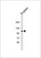 AF4/FMR2 Family Member 3 antibody, MBS9217019, MyBioSource, Western Blot image 