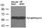 Synaptotagmin 1 antibody, AP09507PU-S, Origene, Western Blot image 