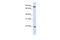 Interferon Alpha 7 antibody, A12237, Boster Biological Technology, Western Blot image 