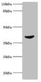Adenosine Deaminase antibody, A50009-100, Epigentek, Western Blot image 