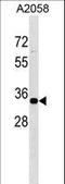 Zinc Finger Protein 570 antibody, LS-C160908, Lifespan Biosciences, Western Blot image 