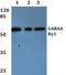Gamma-Aminobutyric Acid Type A Receptor Gamma1 Subunit antibody, PA5-36476, Invitrogen Antibodies, Western Blot image 