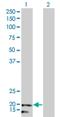 NADH:Ubiquinone Oxidoreductase Subunit B5 antibody, H00004711-M01, Novus Biologicals, Western Blot image 