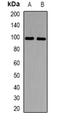 Minichromosome Maintenance 10 Replication Initiation Factor antibody, LS-B14820, Lifespan Biosciences, Western Blot image 