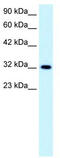 E2F Transcription Factor 5 antibody, TA330135, Origene, Western Blot image 