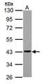 Adenosine Deaminase RNA Specific antibody, PA5-34661, Invitrogen Antibodies, Western Blot image 