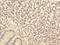 IKBKB Interacting Protein antibody, LS-C675886, Lifespan Biosciences, Immunohistochemistry paraffin image 