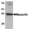 Dorsal Inhibitory Axon Guidance Protein antibody, A09941, Boster Biological Technology, Western Blot image 