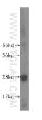 RAB32, Member RAS Oncogene Family antibody, 10999-1-AP, Proteintech Group, Western Blot image 