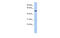 Transmembrane Protein 161B antibody, MBS5300508, MyBioSource, Western Blot image 