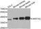 Aflatoxin B1 aldehyde reductase member 2 antibody, TA327011, Origene, Western Blot image 