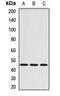 Serpin Family A Member 6 antibody, LS-C667752, Lifespan Biosciences, Western Blot image 