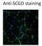 Sarcoglycan Delta antibody, H00006444-M01-100ug, Novus Biologicals, Immunofluorescence image 