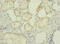 RB Binding Protein 9, Serine Hydrolase antibody, CSB-PA019394LA01HU, Cusabio, Immunohistochemistry paraffin image 
