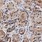 O-6-Methylguanine-DNA Methyltransferase antibody, GTX27045, GeneTex, Immunohistochemistry paraffin image 