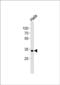 NAD(P)HX Epimerase antibody, PA5-49569, Invitrogen Antibodies, Western Blot image 
