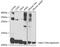Beta-2-Microglobulin antibody, GTX35209, GeneTex, Western Blot image 