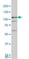 TBC1 domain family member 8 antibody, H00011138-M02, Novus Biologicals, Western Blot image 