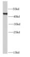 MAA antibody, FNab04933, FineTest, Western Blot image 