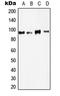 Lysine Acetyltransferase 2B antibody, LS-C353104, Lifespan Biosciences, Western Blot image 