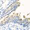 Nyctalopin antibody, GTX32763, GeneTex, Immunohistochemistry paraffin image 