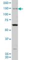 Myosin IIIA antibody, H00053904-M08, Novus Biologicals, Western Blot image 