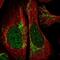 Regulator Of Calcineurin 2 antibody, NBP2-30409, Novus Biologicals, Immunofluorescence image 