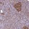 Tripartite Motif Containing 17 antibody, NBP2-49156, Novus Biologicals, Immunohistochemistry frozen image 