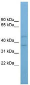 Arylacetamide Deacetylase Like 4 antibody, TA336098, Origene, Western Blot image 