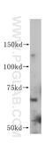 Activin A Receptor Like Type 1 antibody, 14745-1-AP, Proteintech Group, Western Blot image 