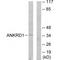 Ankyrin repeat domain-containing protein 1 antibody, A04671, Boster Biological Technology, Western Blot image 