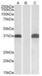 Pim-2 Proto-Oncogene, Serine/Threonine Kinase antibody, AP32855PU-N, Origene, Western Blot image 