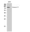 Catenin Beta 1 antibody, STJ92036, St John