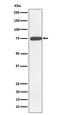 Glucosamine (UDP-N-Acetyl)-2-Epimerase/N-Acetylmannosamine Kinase antibody, M01647, Boster Biological Technology, Western Blot image 