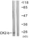 Casein Kinase 2 Beta antibody, LS-C117862, Lifespan Biosciences, Western Blot image 