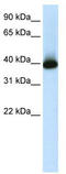 GS Homeobox 2 antibody, TA345526, Origene, Western Blot image 