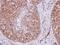 Exportin 6 antibody, NBP2-20925, Novus Biologicals, Immunohistochemistry paraffin image 